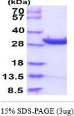 Human DCUN1D1 protein, His tag. GTX68544-pro