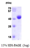 Human NANS protein, His tag. GTX68545-pro
