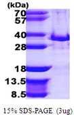 Human Tollip protein, His tag. GTX68549-pro