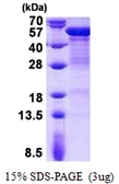 Human Cytokeratin 20 protein, His tag. GTX68550-pro