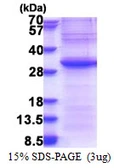 Human EXOSC4 protein, His tag. GTX68551-pro