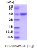 Human LZTFL1 protein, His tag. GTX68553-pro