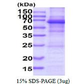 Human DDX56 protein, His tag. GTX68554-pro