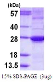 Human ARL15 protein, His tag. GTX68555-pro