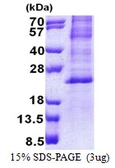 Human HES2 protein, His tag. GTX68556-pro