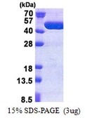 Human TBC1D13 protein, His tag. GTX68557-pro