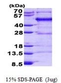 Human FBLIM1 protein, His tag. GTX68558-pro