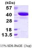 Human GIPC2 protein, His tag. GTX68559-pro