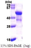 Human NDE1 protein, His tag. GTX68560-pro