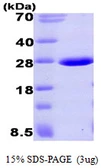 Human Aprataxin protein, His tag. GTX68562-pro