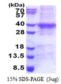 Human UBC3B protein, His tag. GTX68564-pro