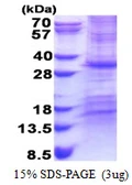 Human CHCHD3 protein, His tag. GTX68565-pro
