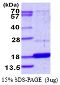 Human DUSP23 protein, His tag. GTX68566-pro