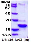 Human TXNL4B protein, His tag. GTX68568-pro