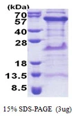 Human TIPIN protein, His tag. GTX68569-pro