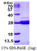 Human Nicotinamide riboside kinase 1 protein, His tag. GTX68570-pro