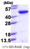 Human PINX1 protein, His tag. GTX68571-pro
