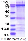 Human ZWILCH protein, His tag. GTX68573-pro
