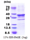 Human CENPQ protein, His tag. GTX68576-pro