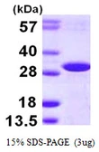 Human DCUN1D2 protein, His tag. GTX68580-pro