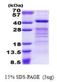 Human DPPA4 protein, His tag. GTX68581-pro