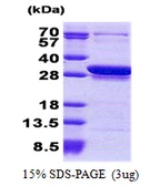 Human CCDC25 protein, His tag. GTX68584-pro