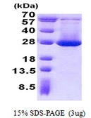 Human ADI1 protein, His tag. GTX68585-pro