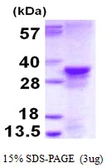 Human MRGBP protein, His tag. GTX68586-pro