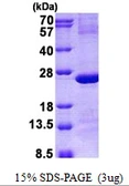 Human IMP3 protein, His tag. GTX68587-pro