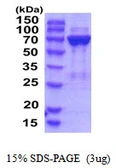 Human PGM2 protein, His tag. GTX68588-pro