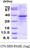 Human CSTP1 protein, His tag. GTX68590-pro