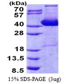 Human IMPACT protein, His tag. GTX68592-pro