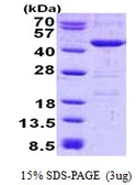 Human YOD1 protein, His tag. GTX68593-pro