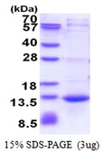 Human CAMK2N1 protein, His tag. GTX68595-pro
