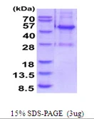 Human ELAC1 protein, His tag. GTX68597-pro