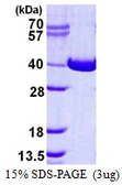 Human NAGK protein, His tag. GTX68598-pro