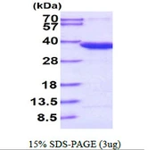 Human OTUB1 protein, His tag. GTX68599-pro