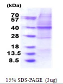 Human OSGEP protein, His tag. GTX68602-pro