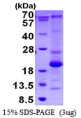 Human ASF1B protein, His tag. GTX68608-pro