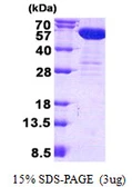 Human CNDP2 protein, His tag. GTX68610-pro