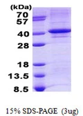 Human TDP1 protein, His tag. GTX68611-pro
