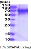 Human TDP1 protein, His tag. GTX68612-pro
