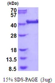 Human LRP2BP protein, His tag. GTX68613-pro