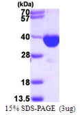 Human PECR protein, His tag. GTX68614-pro