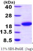 Human THEM2 protein, His tag. GTX68616-pro