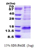 Human BEX1 protein, His tag. GTX68617-pro