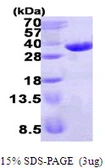 Human ECHDC1 protein, His tag. GTX68619-pro