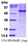 Human HDAC8 protein, His tag. GTX68620-pro