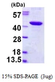 Human PBK protein, His tag. GTX68621-pro
