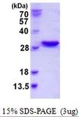 Human NXT2 protein, His tag. GTX68624-pro